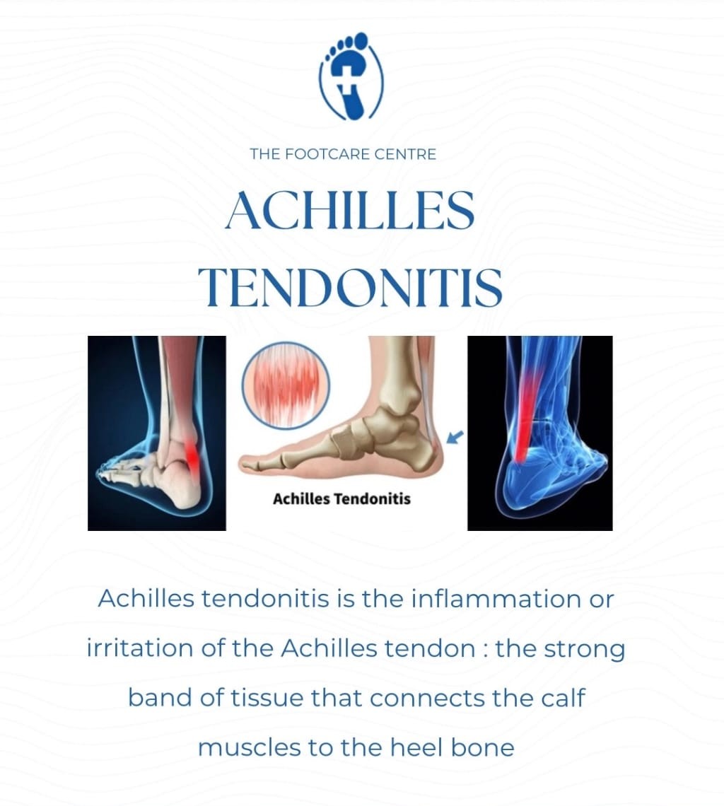 Achilles Tendonitis